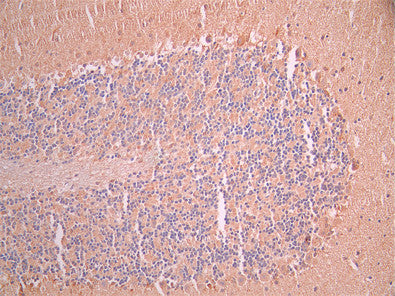 IHC image of CSB-RA859102MA1HU diluted at 1:50 and staining in paraffin-embedded mouse brain tissue performed on a Leica BondTM system. After dewaxing and hydration, antigen retrieval was mediated by high pressure in a citrate buffer (pH 6.0). Section was blocked with 10% normal goat serum 30min at RT. Then primary antibody (1% BSA) was incubated at 4°C overnight. The primary is detected by a Anti-Human lgG, Fcy Fragment Specific labeled by HRP and visualized using 0.05% DAB.