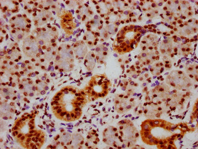 IHC image of CSB-RA859108A463phHU diluted at 1:100 and staining in paraffin-embedded human pancreatic tissue performed on a Leica BondTM system. After dewaxing and hydration, antigen retrieval was mediated by high pressure in a citrate buffer (pH 6.0) . Section was blocked with 10% normal goat serum 30min at RT. Then primary antibody (1% BSA) was incubated at 4℃ overnight. The primary is detected by a biotinylated secondary antibody and visualized using an HRP conjugated SP system.