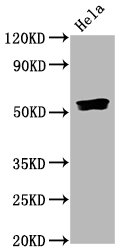 Western Blot
Positive WB detected in Hela whole cell lysate
All lanes Phospho-SMAD5 antibody at 0.835μg/ml
Secondary
Goat polyclonal to rabbit IgG at 1/50000 dilution
Predicted band size: 52 KDa
Observed band size: 52 KDa