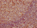 IHC image of CSB-RA859522A0HU diluted at 1:155 and staining in paraffin-embedded human tonsil tissue performed on a Leica BondTM system. After dewaxing and hydration, antigen retrieval was mediated by high pressure in a citrate buffer (pH 6.0) . Section was blocked with 10% normal goat serum 30min at RT. Then primary antibody (1% BSA) was incubated at 4℃ overnight. The primary is detected by a biotinylated secondary antibody and visualized using an HRP conjugated SP system.