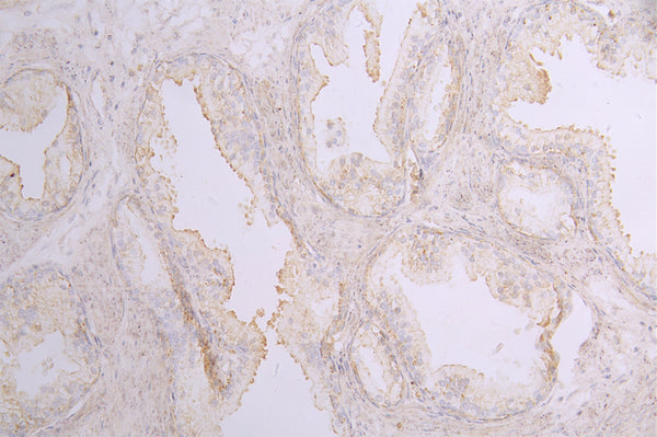 GDF15 Recombinant Monoclonal Antibody – Figure 1 of 1