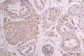 IHC image of CSB-RA860321MA1HU diluted at 1：100 and staining in paraffin-embedded human testis tissue performed on a Leica BondTM system. After dewaxing and hydration, antigen retrieval was mediated by high pressure in a citrate buffer (pH 6.0) . Section was blocked with 10% normal goat serum 30min at RT. Then primary antibody (1% BSA) was incubated at 4°C overnight. The primary is detected by a Goat anti-human polymer IgG labeled by HRP and visualized using 0.05% DAB.