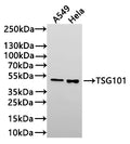 Western Blot
Positive WB detected in: A549 whole cell lysate(20µg) , HeLa whole cell lysate(20µg) 
All lanes: TSG101 antibody at 1:1000
Secondary
Goat polyclonal to rabbit IgG at 1/40000 dilution
Predicted band size: 44 kDa
Observed band size: 44 kDa
Exposure time：2min