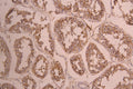 IHC image of CSB-RA866317MA1HU diluted at 1：50 and staining in paraffin-embedded human testis tissue performed on a Leica BondTM system. After dewaxing and hydration, antigen retrieval was mediated by high pressure in a citrate buffer (pH 6.0) . Section was blocked with 10% normal goat serum 30min at RT. Then primary antibody (1% BSA) was incubated at 4°C overnight. The primary is detected by a Anti-Human lgG, Fcy Fragment Specific labeled by HRP and visualized using 0.05% DAB.