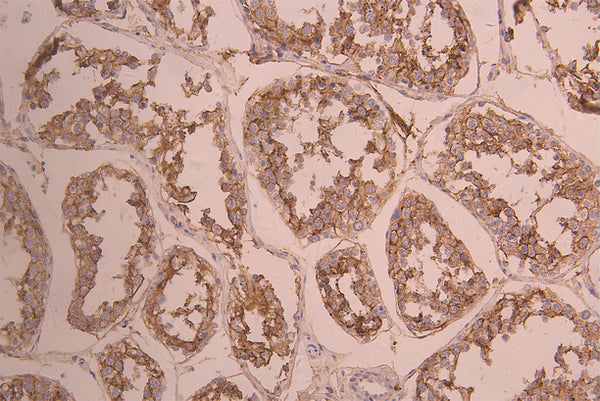 IHC image of CSB-RA866317MA1HU diluted at 1：50 and staining in paraffin-embedded human testis tissue performed on a Leica BondTM system. After dewaxing and hydration, antigen retrieval was mediated by high pressure in a citrate buffer (pH 6.0) . Section was blocked with 10% normal goat serum 30min at RT. Then primary antibody (1% BSA) was incubated at 4°C overnight. The primary is detected by a Anti-Human lgG, Fcy Fragment Specific labeled by HRP and visualized using 0.05% DAB.