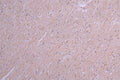 IHC image of CSB-RA867113MA1HU diluted at 1:100 and staining in paraffin-embedded human brain tissue performed on a Leica BondTM system. After dewaxing and hydration, antigen retrieval was mediated by high pressure in a citrate buffer (pH 6.0) . Section was blocked with 10% normal goat serum 30min at RT. Then primary antibody (1% BSA) was incubated at 4°C overnight. The primary is detected by a Goat anti-Human IgG labeled by HRP and visualized using 0.05% DAB.