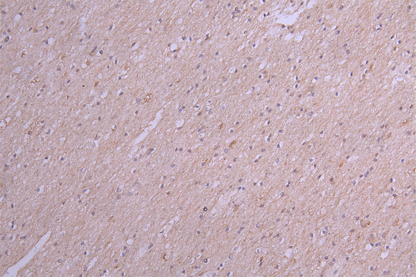 IHC image of CSB-RA867113MA1HU diluted at 1:100 and staining in paraffin-embedded human brain tissue performed on a Leica BondTM system. After dewaxing and hydration, antigen retrieval was mediated by high pressure in a citrate buffer (pH 6.0) . Section was blocked with 10% normal goat serum 30min at RT. Then primary antibody (1% BSA) was incubated at 4°C overnight. The primary is detected by a Goat anti-Human IgG labeled by HRP and visualized using 0.05% DAB.
