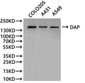 Western Blot
Positive WB detected in: COLO205 whole cell lysate(30µg), A431 whole cell lysate(30µg), A549 whole cell lysate(30µg)
All lanes:DAP antibody at 1:1000
Secondary
Goat polyclonal to rabbit IgG at 1/40000 dilution
Predicted band size: 160 kDa
Observed band size: 160 kDa
Exposure time：1min