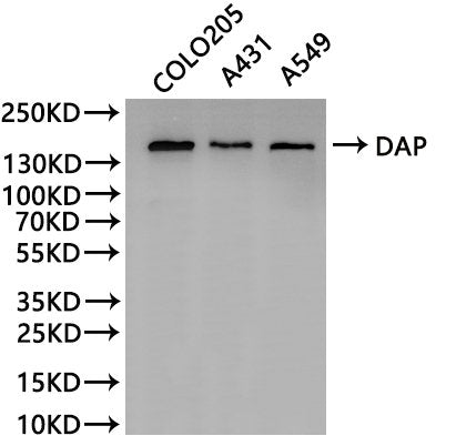 Western Blot
Positive WB detected in: COLO205 whole cell lysate(30µg), A431 whole cell lysate(30µg), A549 whole cell lysate(30µg)
All lanes:DAP antibody at 1:1000
Secondary
Goat polyclonal to rabbit IgG at 1/40000 dilution
Predicted band size: 160 kDa
Observed band size: 160 kDa
Exposure time：1min