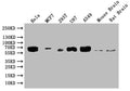 Western Blot
Positive WB detected in: Hela whole cell lysate, MCF-7 whole cell lysate, 293T whole cell lysate, U87 whole cell lysate
All lanes: GBA antibody at 1:2000
Secondary
Goat polyclonal to rabbit IgG at 1/50000 dilution
Predicted band size: 60, 58, 55, 51, 30 kDa
Observed band size: 60 kDa