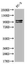 Western Blot
Positive WB detected in: Hela whole cell lysate
All lanes: KIFAP3 antibody at 1:2000
Secondary
Goat polyclonal to rabbit IgG at 1/50000 dilution
Predicted band size: 92, 87, 83 kDa
Observed band size: 72-95 kDa