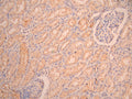IHC image of CSB-RA872541MA1HU diluted at 1:50 and staining in paraffin-embedded human kidney tissue performed on a Leica BondTM system. After dewaxing and hydration, antigen retrieval was mediated by high pressure in a citrate buffer (pH 6.0). Section was blocked with 10% normal goat serum 30min at RT. Then primary antibody (1% BSA) was incubated at 4°C overnight. The primary is detected by a Anti-Human lgG, Fcy Fragment Specific labeled by HRP and visualized using 0.05% DAB.