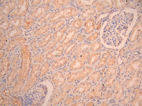 IHC image of CSB-RA872541MA1HU diluted at 1:50 and staining in paraffin-embedded human kidney tissue performed on a Leica BondTM system. After dewaxing and hydration, antigen retrieval was mediated by high pressure in a citrate buffer (pH 6.0). Section was blocked with 10% normal goat serum 30min at RT. Then primary antibody (1% BSA) was incubated at 4°C overnight. The primary is detected by a Anti-Human lgG, Fcy Fragment Specific labeled by HRP and visualized using 0.05% DAB.
