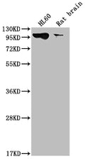 Western Blot
Positive WB detected in: HL60 whole cell lysate, Rat brain tissue
All lanes: DNM2 antibody at 1:2000
Secondary
Goat polyclonal to rabbit IgG at 1/50000 dilution
Predicted band size: 99, 98 kDa
Observed band size: 99 kDa