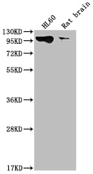 Western Blot
Positive WB detected in: HL60 whole cell lysate, Rat brain tissue
All lanes: DNM2 antibody at 1:2000
Secondary
Goat polyclonal to rabbit IgG at 1/50000 dilution
Predicted band size: 99, 98 kDa
Observed band size: 99 kDa