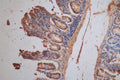 IHC image of CSB-RA878859MA1HU diluted at 1:200 and staining in paraffin-embedded human small intestine tissue performed on a Leica BondTM system. After dewaxing and hydration,  antigen retrieval was mediated by high pressure in a citrate buffer (pH 6.0) . Section was blocked with 10% normal goat serum 30min at RT. Then primary antibody (1% BSA) was incubated at 4°C overnight. The primary is detected by a Goat anti-Mouse IgG labeled by HRP and visualized using 0.05% DAB.