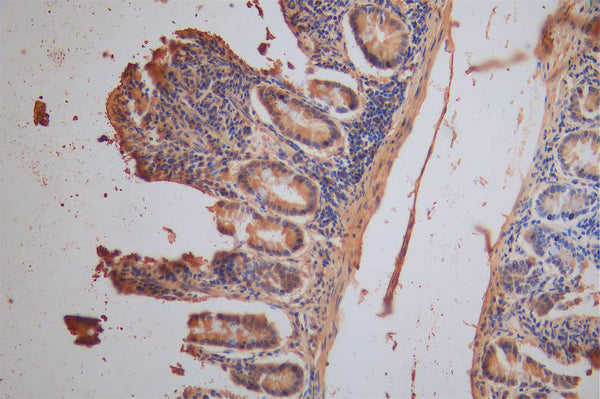IHC image of CSB-RA878859MA1HU diluted at 1:200 and staining in paraffin-embedded human small intestine tissue performed on a Leica BondTM system. After dewaxing and hydration,  antigen retrieval was mediated by high pressure in a citrate buffer (pH 6.0) . Section was blocked with 10% normal goat serum 30min at RT. Then primary antibody (1% BSA) was incubated at 4°C overnight. The primary is detected by a Goat anti-Mouse IgG labeled by HRP and visualized using 0.05% DAB.