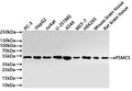 Western Blot
Positive WB detected in: PC-3 whole cell lysate(20µg) ,HepG2 whole cell lysate(20µg) , Jurkat whole cell lysate(20µg) , U-251MG whole cell lysate(20µg) ,A549 whole cell lysate(20µg) ,MCF-7 whole cell lysate(20µg) ,HEK293 whole cell lysate(20µg) ,Mouse brain tissue lysate(20µg) ,Rat brain tissue lysate(20µg) 
All lanes: PSMC5 antibody at 1:1000
Secondary
Goat polyclonal to rabbit IgG at 1/40000 dilution
Predicted band size: 46 kDa
Observed band size: 50 kDa
Exposure time：1min