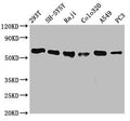 Western Blot
Positive WB detected in: 293T whole cell lysate, SH-SY5Y whole cell lysate, Raji whole cell lysate, Colo320 whole cell lysate, A549 whole cell lysate, PC3 whole cell lysate
All lanes: FTO antibody at 0.7μg/ml
Secondary
Goat polyclonal to rabbit IgG at 1/50000 dilution
Predicted band size: 59, 15, 7, 13 KDa
Observed band size: 59 KDa