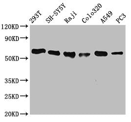 Western Blot
Positive WB detected in: 293T whole cell lysate, SH-SY5Y whole cell lysate, Raji whole cell lysate, Colo320 whole cell lysate, A549 whole cell lysate, PC3 whole cell lysate
All lanes: FTO antibody at 0.7μg/ml
Secondary
Goat polyclonal to rabbit IgG at 1/50000 dilution
Predicted band size: 59, 15, 7, 13 KDa
Observed band size: 59 KDa