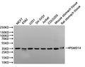 Western Blot
Positive WB detected in: MCF7 whole cell lysate(30µg), K562 whole cell lysate(30µg), U251 whole cell lysate(30µg), SH-SY5Y whole cell lysate(30µg), Jurkat whole cell lysate(30µg), COLO205 whole cell lysate(30µg), Mouse stomach tissue lysate(30µg), Rat stomach tissue lysate(30µg)
All lanes:PSMD14 antibody at 1:1000
Secondary
Goat polyclonal to rabbit IgG at 1/40000 dilution
Predicted band size: 35 kDa
Observed band size: 35 kDa
Exposure time：1min