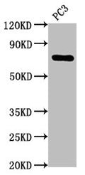 TP63 Antibody – Figure 1 of 2