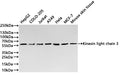 Western Blot
Positive WB detected in: HepG2 whole cell lysate(20µg) ,COLO-205 whole cell lysate(20µg) ,Jurkat whole cell lysate(20µg) , A549 whole cell lysate(20µg) ,Hela whole cell lysate(20µg) ,MCF-7 whole cell lysate(20µg) ,Mouse skin tissue lysate(20µg) 
All lanes: Kinesin light chain 3 antibody at 1:1000
Secondary
Goat polyclonal to rabbit IgG at 1/40000 dilution
Predicted band size: 55 kDa
Observed band size: 57 kDa
Exposure time：2s
