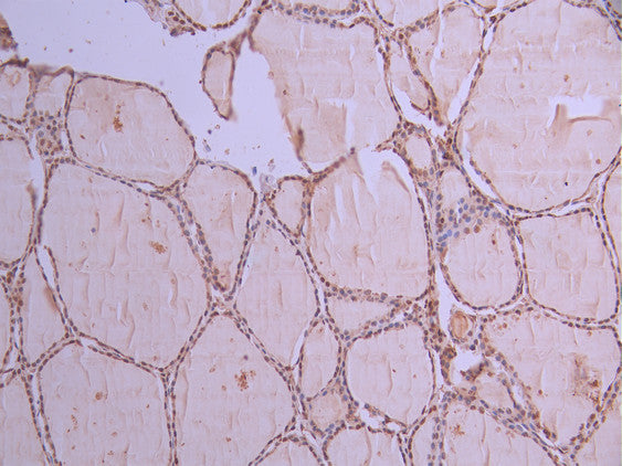 IHC image of CSB-RA889767A0HU diluted at 1:100 and staining in paraffin-embedded human thyroid tissue performed on a Leica BondTM system. After dewaxing and hydration, antigen retrieval was mediated by high pressure in a citrate buffer (pH 6.0) . Section was blocked with 10% normal goat serum 30min at RT. Then primary antibody (1% BSA) was incubated at 4°C overnight. The primary is detected by a Goat anti-rabbit polymer IgG labeled by HRP and visualized using 0.05% DAB.