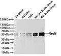 Western Blot
Positive WB detected in: SH-SY5Y whole cell lysate(30µg) , HEK293 whole cell lysate(30µg) , Hela whole cell lysate(30µg) , Mouse brain tissue lysate(30µg) , Rat brain tissue lysate(30µg) 
All lanes: NeuN antibody at 1:1000
Secondary
Goat polyclonal to rabbit IgG at 1/40000 dilution
Predicted band size: 34 kDa
Observed band size: 46-55 kDa
Exposure time：40s
