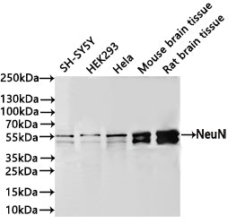 Western Blot
Positive WB detected in: SH-SY5Y whole cell lysate(30µg) , HEK293 whole cell lysate(30µg) , Hela whole cell lysate(30µg) , Mouse brain tissue lysate(30µg) , Rat brain tissue lysate(30µg) 
All lanes: NeuN antibody at 1:1000
Secondary
Goat polyclonal to rabbit IgG at 1/40000 dilution
Predicted band size: 34 kDa
Observed band size: 46-55 kDa
Exposure time：40s