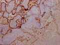 IHC image of CSB-RA891358A0HU diluted at 1:100 and staining in paraffin-embedded human placenta tissue performed on a Leica BondTM system. After dewaxing and hydration, antigen retrieval was mediated by high pressure in a citrate buffer (pH 6.0) . Section was blocked with 10% normal goat serum 30min at RT. Then primary antibody (1% BSA) was incubated at 4℃ overnight. The primary is detected by a Goat anti-rabbit IgG polymer labeled by HRP and visualized using 0.05% DAB.