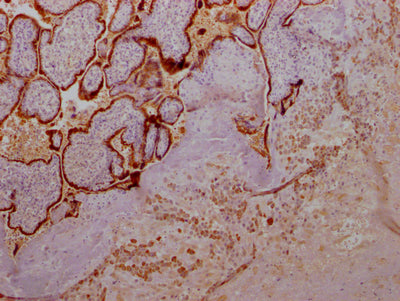 IHC image of CSB-RA891358A0HU diluted at 1:100 and staining in paraffin-embedded human placenta tissue performed on a Leica BondTM system. After dewaxing and hydration, antigen retrieval was mediated by high pressure in a citrate buffer (pH 6.0) . Section was blocked with 10% normal goat serum 30min at RT. Then primary antibody (1% BSA) was incubated at 4℃ overnight. The primary is detected by a Goat anti-rabbit IgG polymer labeled by HRP and visualized using 0.05% DAB.