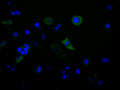 Immunofluorescence staining of HepG2 cell with CSB-RA895988A0HU at 1:50, counter-stained with DAPI. The cells were fixed in 4% formaldehyde, permeabilized using 0.2% Triton X-100 and blocked in 10% normal Goat Serum. The cells were then incubated with the antibody overnight at 4°C. The secondary antibody was Alexa Fluor 488-congugated AffiniPure Goat Anti-Rabbit IgG(H+L) .