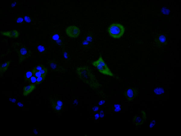 Immunofluorescence staining of HepG2 cell with CSB-RA895988A0HU at 1:50, counter-stained with DAPI. The cells were fixed in 4% formaldehyde, permeabilized using 0.2% Triton X-100 and blocked in 10% normal Goat Serum. The cells were then incubated with the antibody overnight at 4°C. The secondary antibody was Alexa Fluor 488-congugated AffiniPure Goat Anti-Rabbit IgG(H+L) .