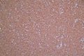 IHC image of CSB-RA896760MA1HU diluted at 1:30 and staining in paraffin-embedded human brain tissue performed on a Leica BondTM system. After dewaxing and hydration,  antigen retrieval was mediated by high pressure in a citrate buffer (pH 6.0) . Section was blocked with 10% normal goat serum 30min at RT. Then primary antibody (1% BSA) was incubated at 4°C overnight. The primary is detected by a Goat anti-Mouse IgG labeled by HRP and visualized using 0.05% DAB.
