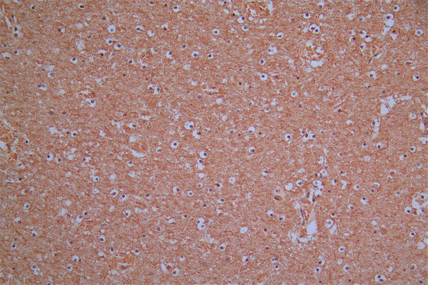 IHC image of CSB-RA896760MA1HU diluted at 1:30 and staining in paraffin-embedded human brain tissue performed on a Leica BondTM system. After dewaxing and hydration,  antigen retrieval was mediated by high pressure in a citrate buffer (pH 6.0) . Section was blocked with 10% normal goat serum 30min at RT. Then primary antibody (1% BSA) was incubated at 4°C overnight. The primary is detected by a Goat anti-Mouse IgG labeled by HRP and visualized using 0.05% DAB.