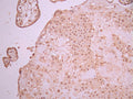 IHC image of CSB-RA896869MA2HU diluted at 1:50 and staining in paraffin-embedded human placenta tissue performed on a Leica BondTM system. After dewaxing and hydration, antigen retrieval was mediated by high pressure in a citrate buffer (pH 6.0). Section was blocked with 10% normal goat serum 30min at RT. Then primary antibody (1% BSA) was incubated at 4°C overnight. The primary is detected by a Anti-Human lgG, Fcy Fragment Specific labeled by HRP and visualized using 0.05% DAB.