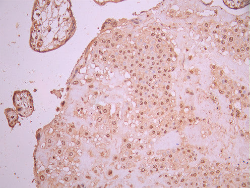 IHC image of CSB-RA896869MA2HU diluted at 1:50 and staining in paraffin-embedded human placenta tissue performed on a Leica BondTM system. After dewaxing and hydration, antigen retrieval was mediated by high pressure in a citrate buffer (pH 6.0). Section was blocked with 10% normal goat serum 30min at RT. Then primary antibody (1% BSA) was incubated at 4°C overnight. The primary is detected by a Anti-Human lgG, Fcy Fragment Specific labeled by HRP and visualized using 0.05% DAB.