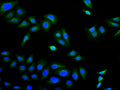 Immunofluorescence staining of Hela cell with CSB-RA897314MA1HU at 1:30 ,counter-stained with DAPI. The cells were fixed in 4% formaldehyde, permeabilized using 0.2% Triton X-100 and blocked in 10% normal Goat Serum. The cells were then incubated with the antibody overnight at 4°C. The secondary antibody was Fluorescein (FITC) AffiniPure Goat Anti-Human IgG, Fcγ fragment specific.