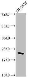RHOA Antibody – Figure 1 of 1