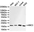 Western Blot
Positive WB detected in: Hela whole cell lysate(30µg) , MCF-7 whole cell lysate(30µg) , Jurkat whole cell lysate(30µg) , K562 whole cell lysate(30µg) 
All lanes: BBC3 antibody at 1:1000
Secondary
Goat polyclonal to rabbit IgG at 1/40000 dilution
Predicted band size: 21 kDa
Observed band size: 18 kDa
Exposure time：1min