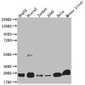 Western Blot
Positive WB detected in: HepG2 whole cell lysate, Ntera-2 whole cell lysate, Jurkat whole cell lysate, A549 whole cell lysate, Hela whole cell lysate, Mouse liver tissue
All lanes: NQO2 antibody at 1:2000
Secondary
Goat polyclonal to rabbit IgG at 1/50000 dilution
Predicted band size: 26 kDa
Observed band size: 26 kDa