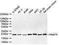 Western Blot
Positive WB detected in: U-87MG whole cell lysate(30µg) , PC-3 whole cell lysate(30µg) , A549 whole cell lysate(30µg) , Hela whole cell lysate(30µg) , A431 whole cell lysate(30µg) , HT-29 whole cell lysate(30µg) , Rat brain tissue lysate(30µg) 
All lanes: Rab7A antibody at 1:1000
Secondary
Goat polyclonal to rabbit IgG at 1/40000 dilution
Predicted band size: 23 kDa
Observed band size: 23 kDa
Exposure time：2min