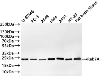 Western Blot
Positive WB detected in: U-87MG whole cell lysate(30µg) , PC-3 whole cell lysate(30µg) , A549 whole cell lysate(30µg) , Hela whole cell lysate(30µg) , A431 whole cell lysate(30µg) , HT-29 whole cell lysate(30µg) , Rat brain tissue lysate(30µg) 
All lanes: Rab7A antibody at 1:1000
Secondary
Goat polyclonal to rabbit IgG at 1/40000 dilution
Predicted band size: 23 kDa
Observed band size: 23 kDa
Exposure time：2min