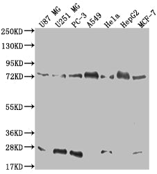 Western Blot
Positive WB detected in: U87 whole cell lysate, U251 whole cell lysate, PC3 whole cell lysate, A549 whole cell lysate, Hela whole cell lysate, HepG2 whole cell lysate, MCF-7 whole cell lysate
All lanes: CAPN2 antibody at 1:500
Secondary
Goat polyclonal to rabbit IgG at 1/50000 dilution
Predicted band size: 80, 72 kDa
Observed band size: 72-95 kDa
