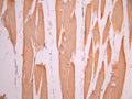 IHC image of CSB-RA900765A0HU diluted at 1:100 and staining in paraffin-embedded human skeletal muscle tissue performed on a Leica BondTM system. After dewaxing and hydration, antigen retrieval was mediated by high pressure in a citrate buffer (pH 6.0). Section was blocked with 10% normal goat serum 30min at RT. Then primary antibody (1% BSA) was incubated at 4°C overnight. The primary is detected by a Goat anti-rabbit polymer IgG labeled by HRP and visualized using 0.05% DAB.