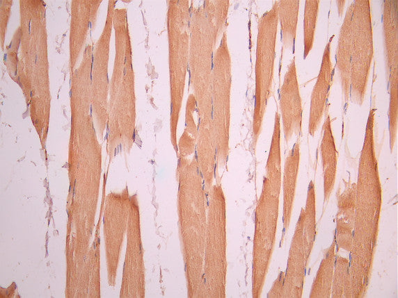IHC image of CSB-RA900765A0HU diluted at 1:100 and staining in paraffin-embedded human skeletal muscle tissue performed on a Leica BondTM system. After dewaxing and hydration, antigen retrieval was mediated by high pressure in a citrate buffer (pH 6.0). Section was blocked with 10% normal goat serum 30min at RT. Then primary antibody (1% BSA) was incubated at 4°C overnight. The primary is detected by a Goat anti-rabbit polymer IgG labeled by HRP and visualized using 0.05% DAB.