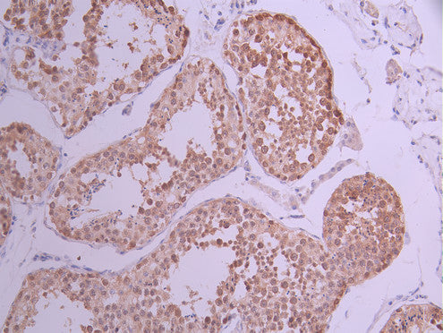 IHC image of CSB-RA901089A0HU diluted at 1:100 and staining in paraffin-embedded human testis tissue performed on a Leica BondTM system. After dewaxing and hydration, antigen retrieval was mediated by high pressure in a citrate buffer (pH 6.0) . Section was blocked with 10% normal goat serum 30min at RT. Then primary antibody (1% BSA) was incubated at 4°C overnight. The primary is detected by a Goat anti-rabbit polymer IgG labeled by HRP and visualized using 0.05% DAB.