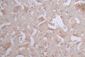 IHC image of CSB-RA901354A0HU diluted at 1:50 and staining in paraffin-embedded human brain tissue performed on a Leica BondTM system. After dewaxing and hydration, antigen retrieval was mediated by high pressure in a citrate buffer (pH 6.0) . Section was blocked with 10% normal goat serum 30min at RT. Then primary antibody (1% BSA) was incubated at 4°C overnight. The primary is detected by a Goat anti-rabbit polymer IgG labeled by HRP and visualized using 0.11% DAB.