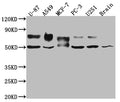 Western Blot
Positive WB detected in: U-87 whole cell lysate, A549 whole cell lysate, MCF-7 whole cell lysate, PC-3 whole cell lysate, U-251 whole cell lysate, Mouse Brain whole cell lysate
All lanes: 5T4 antibody at 1:1000
Secondary
Goat polyclonal to rabbit IgG at 1/50000 dilution
Predicted band size: 47 kDa
Observed band size: 50, 80 kDa